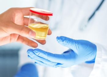 Ciri-ciri Gagal Ginjal yang Dapat Dilihat dari Air Kencing