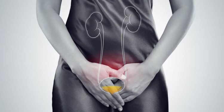 Fakta Honeymoon Cystitis yang Ramai di TikTok dan Bikin Tak Nyaman