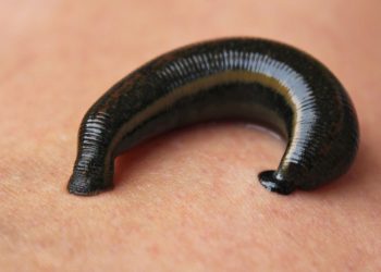 Mimisan Berkepanjangan, Lintah Ditemukan Bersarang di Hidung Pria Ini