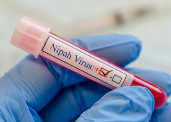 Virus Nipah Ditemukan pada Kelelawar di Indonesia
